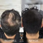 Buy original Batci hair concealer cream and Caviii hair concealer cream in Pakistan for instant bald spot coverage.