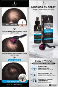 Caviii Minoxidil 5 Percent Spray 100ml with Derma Roller for Hair Regrowth and Beard Growth