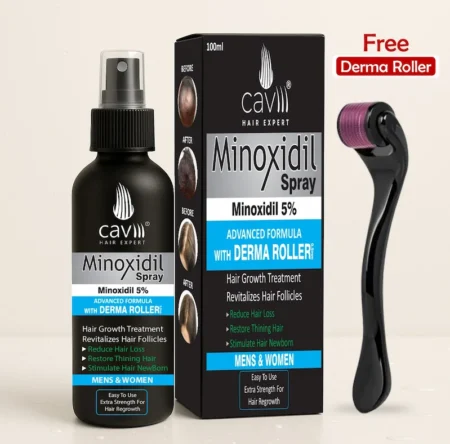 Minoxidil 5 percent spray in Pakistan for thinning hair treatment